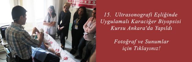 15 Ultrasonografi Eşliğinde Uygulamalı Karaciğer Biyopsisi Kursu Ankara'da Yapıldı