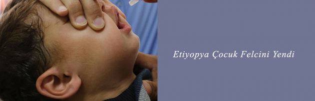 Etiyopya Çocuk Felcini Yendi