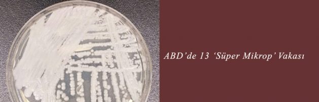 ABD’de 13 ‘Süper Mikrop’ Vakası