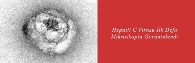 Hepatit C Virusu İlk Defa Mikroskopta Görüntülendi
